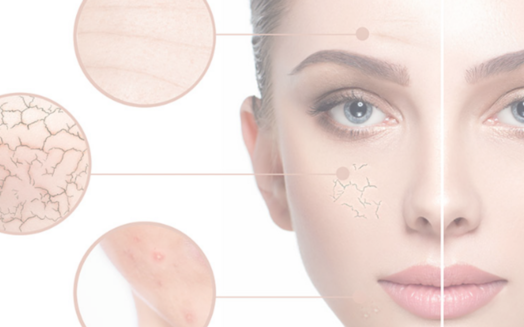News 2025: check-up della Pelle Relilax®: benessere su misura per la tua pelle